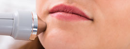 Microdermabrasion: Hautpflege mit Tiefenwirkung